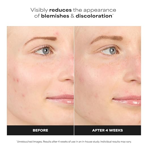 Paula's Choice Azelaic Acid Booster - Image 3