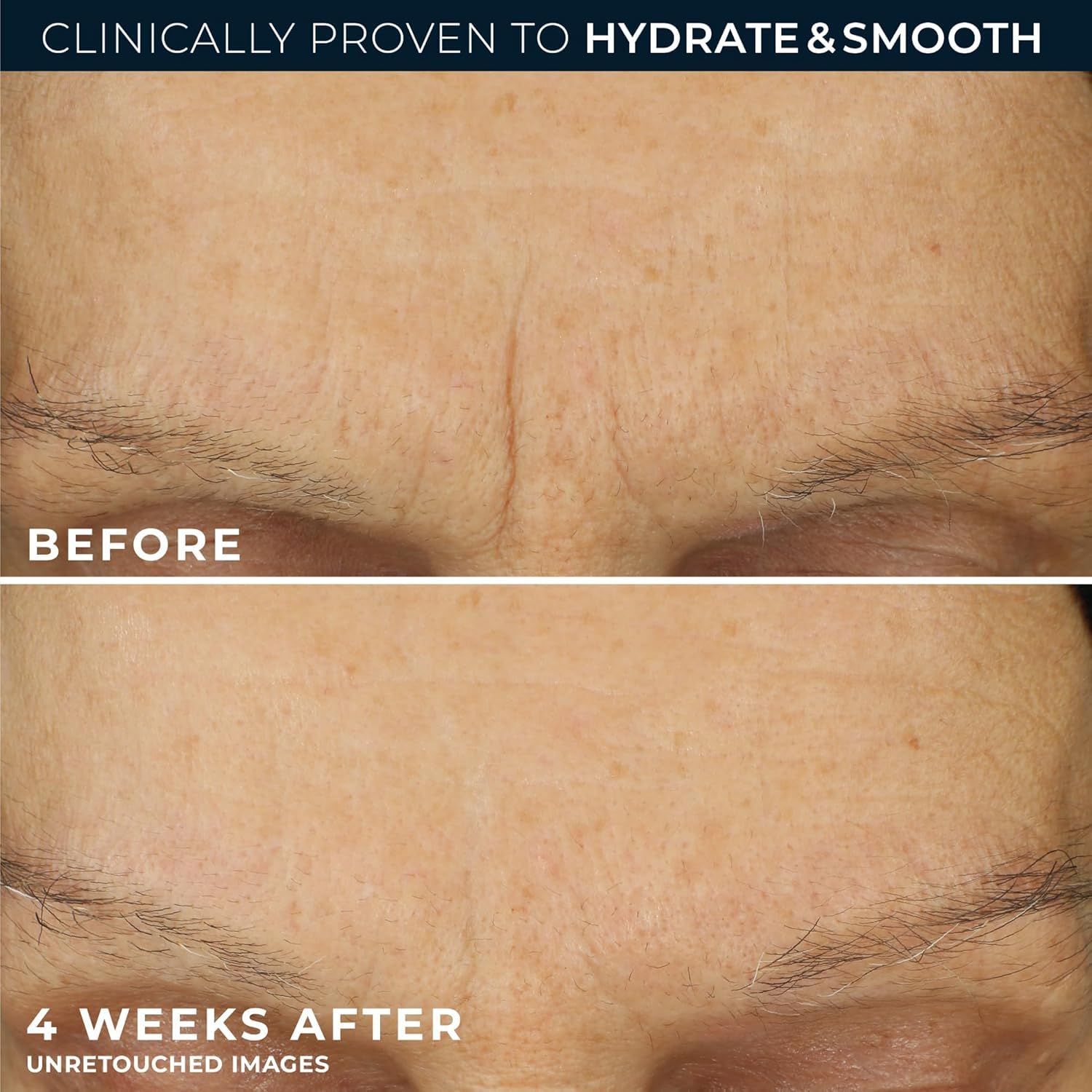RoC Retinol Correxion Max Hydration Moisturizer (1.7 oz) - Image 2